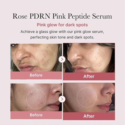 PDRN Pink Peptide Serum - Glow, Firmness amp Soothed Skin